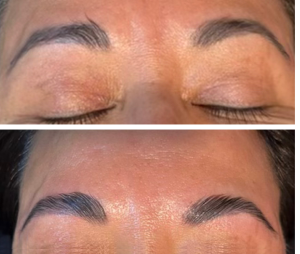 Brow Lamination 300x254